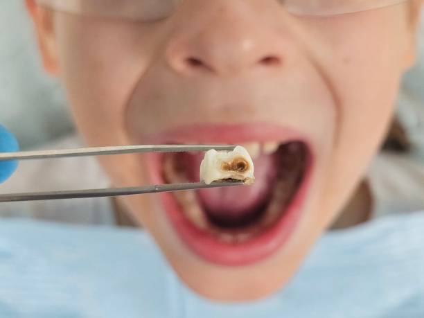 Best Weekend Emergency Dentist in Burnsville, NC